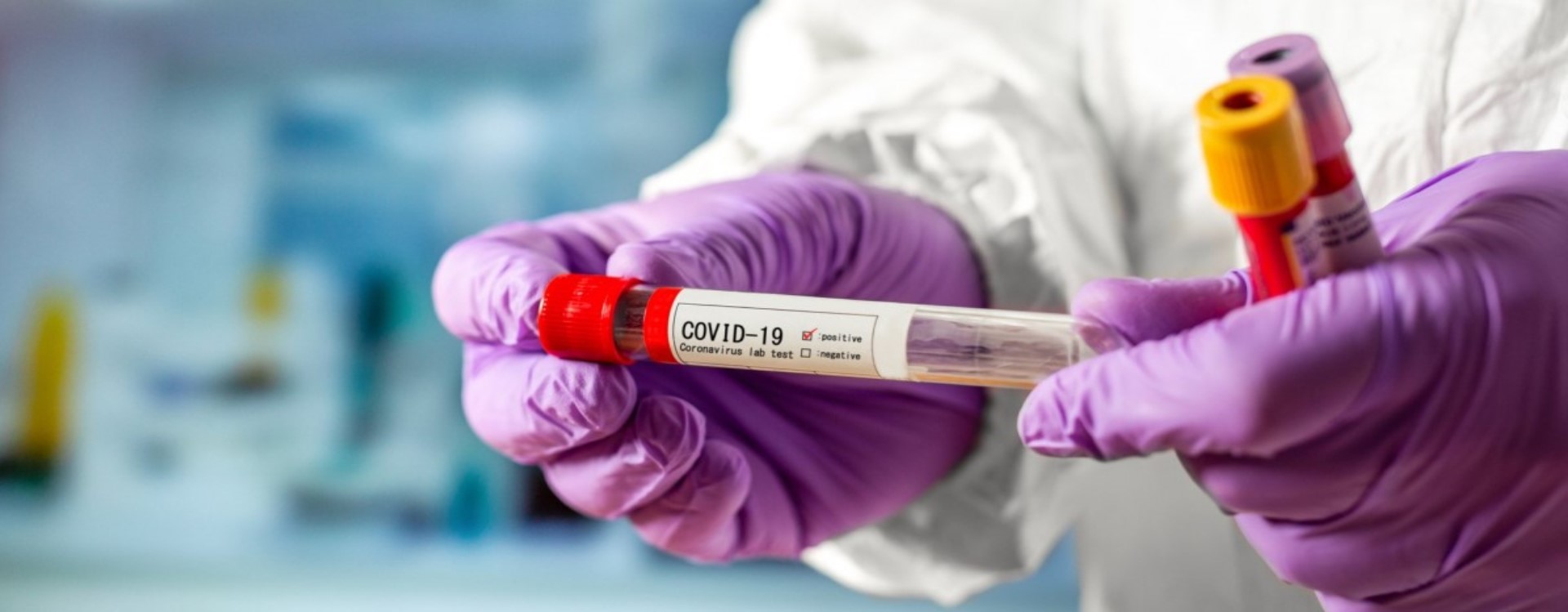  Тестирование украинцев на наличие антител к COVID-19: где можно будет сделать тест бесплатно 