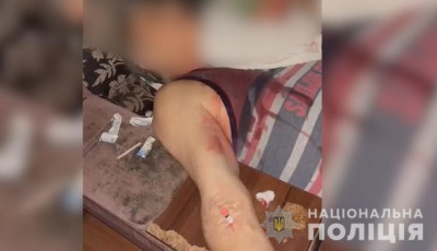 Мати шістьох  дітей встромила ніж у співмешканця: поліція Київщини відкрила кримінальне провадження