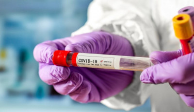Тестирование украинцев на наличие антител к COVID-19: где можно будет сделать тест бесплатно